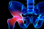 Femoroacetabular Impingement: Types, Causes, Symptoms and Treatment Options