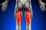 What is a Proximal Hamstring Tear & The Repair Options?