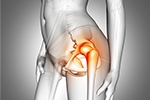 When To See an Orthopedic Surgeon for Hip Pain
