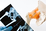 Why Young Athletes Shouldn’t Ignore Persistent Hip Pain
