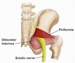 Piriformis Syndrome Treatment Des Plaines | Hip & Knee ...