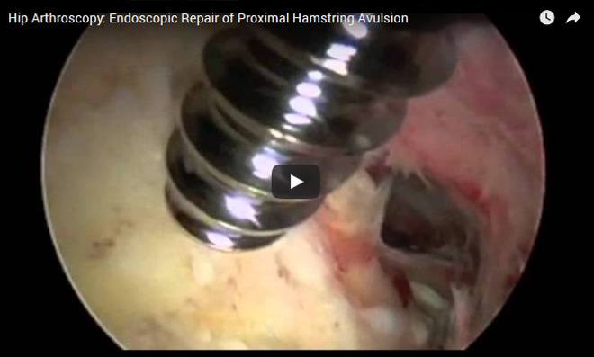 surgical video24
