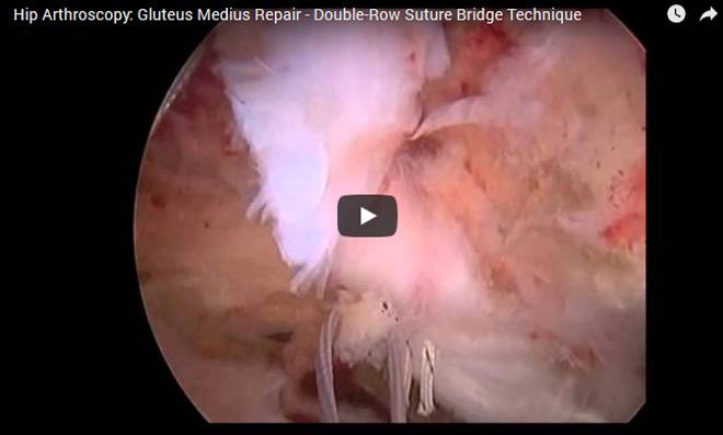 surgical video35