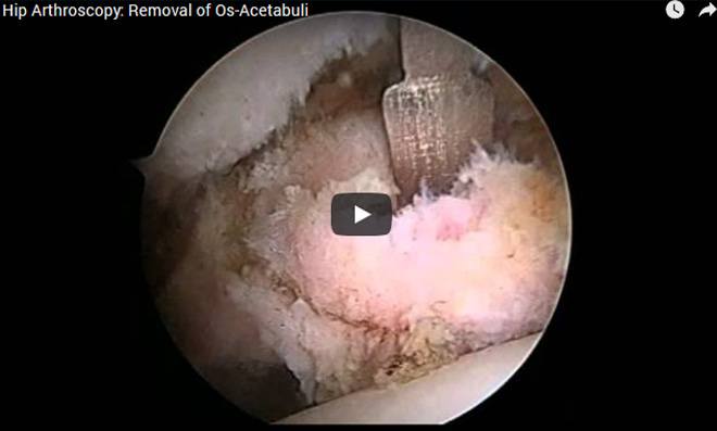 surgical video40