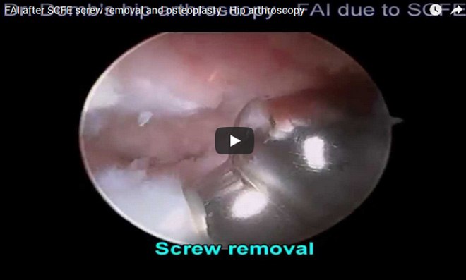 surgical video45