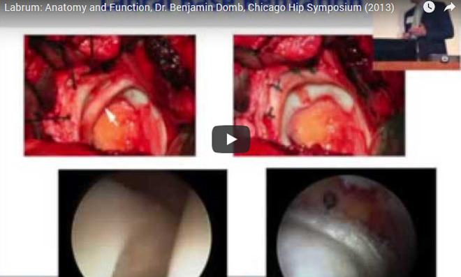 surgical video6
