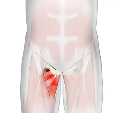 Causes of Athletic Pubalgia - Benjamin Domb MD