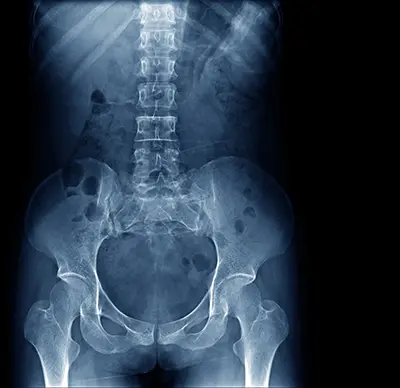 Diagnosis of Core Muscle Injury - Benjamin Domb MD