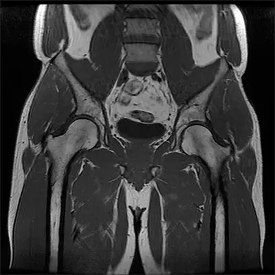 Diagnosis - Benjamin Domb MD