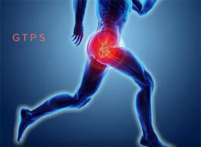 Greater Trochanter Pain Syndrome - Benjamin Domb MD