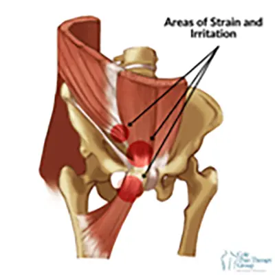 Surgical treatment - Benjamin Domb MD