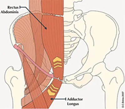 Surgical Treatments - Benjamin Domb MD