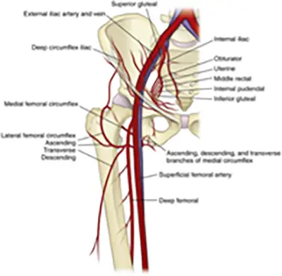 Causes of Perthes Disease - Benjamin Domb MD