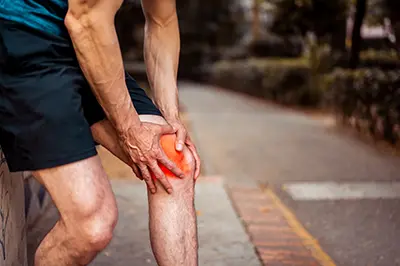 Knee Arthritis - 3 - Educational Photo