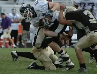 ACL Tear - 2 - Educational Photo