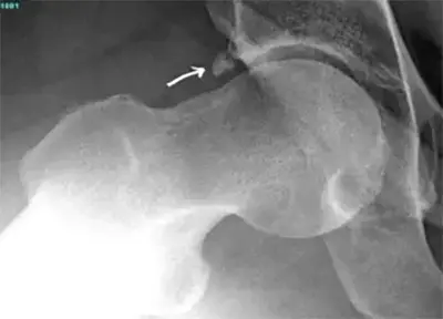 Loose Bodies - Benjamin Domb MD