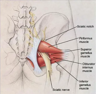 Piriformis Syndrome - Benjamin Domb MD