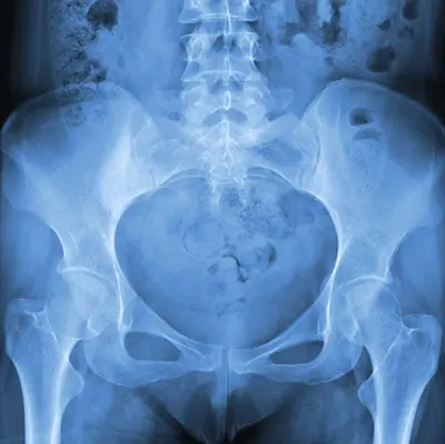 Diagnosis Athletic Pubalgia - Benjamin Domb MD