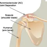 Acromioclavicular (AC) Joint Injuries