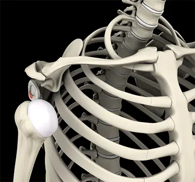 Shoulder Instability - Benjamin Domb MD