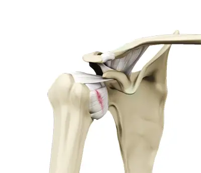 Shoulder Anatomy - 4 - Educational Photo