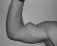 Bicep Tendon Tears and Tendonitis1