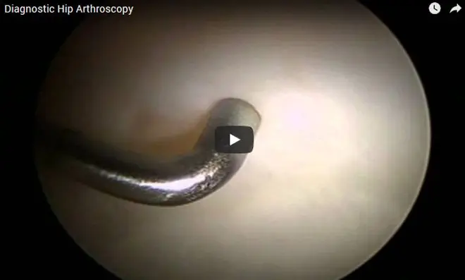 surgical video38