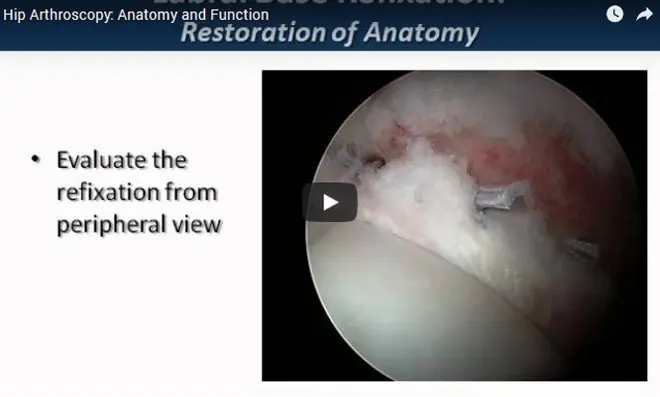 surgical video39