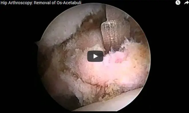 surgical video40