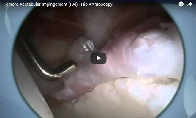 surgical video43
