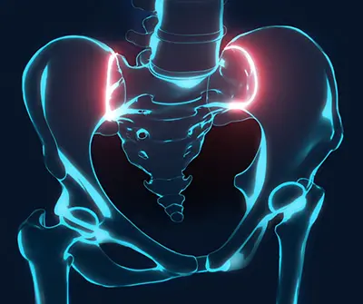 What is the Sacroiliac Joint - Benjamin Domb MD